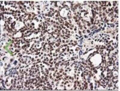 Immunohistochemistry: NUDT18 Antibody (OTI5D7) - Azide and BSA Free [NBP2-73110]