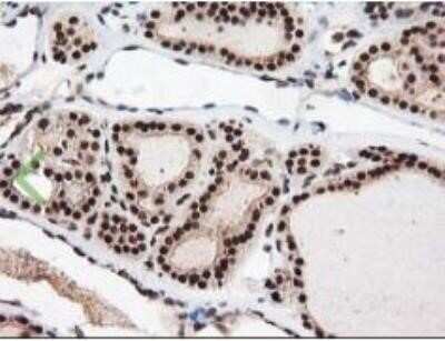 Immunohistochemistry: NUDT18 Antibody (OTI5D7) - Azide and BSA Free [NBP2-73110]