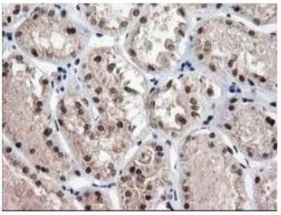 Immunohistochemistry: NUDT18 Antibody (OTI5D7) - Azide and BSA Free [NBP2-73110]