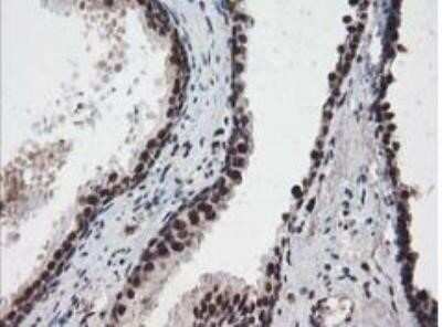 Immunohistochemistry: NUDT18 Antibody (OTI5D7) - Azide and BSA Free [NBP2-73110]