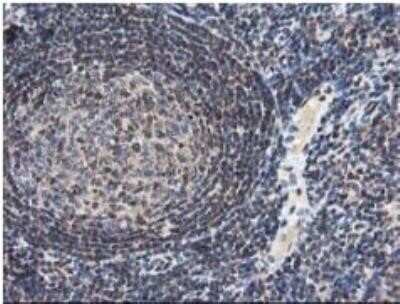 Immunohistochemistry: NUDT18 Antibody (OTI5D7) - Azide and BSA Free [NBP2-73110]