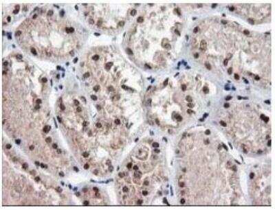 Immunohistochemistry-Paraffin: NUDT18 Antibody (OTI5D7) [NBP2-01432]