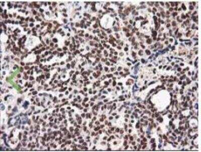 Immunohistochemistry-Paraffin: NUDT18 Antibody (OTI5D7) [NBP2-01432]