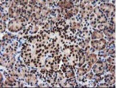 Immunohistochemistry-Paraffin: NUDT18 Antibody (OTI5D7) [NBP2-01432]