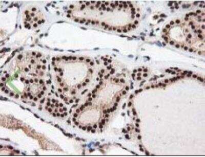 Immunohistochemistry-Paraffin: NUDT18 Antibody (OTI5D7) [NBP2-01432]