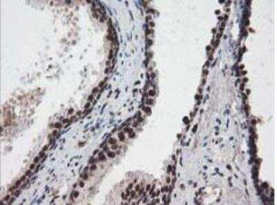 Immunohistochemistry-Paraffin: NUDT18 Antibody (OTI5D7) [NBP2-01432]