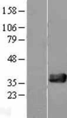 Western Blot: NUDT18 Overexpression Lysate [NBL1-13858]