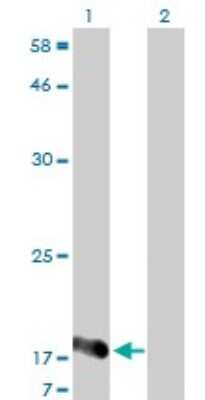 Western Blot: NUDT2 Antibody (4A4-3C3) [H00000318-M01]