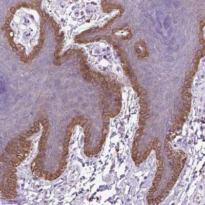 Immunohistochemistry: NUDT2 Antibody [NBP2-49521]