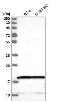 Western Blot: NUDT2 Antibody [NBP2-55236]