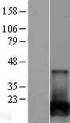 Western Blot: NUDT2 Overexpression Lysate [NBL1-13859]