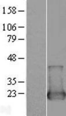 Western Blot: NUDT2 Overexpression Lysate [NBL1-13860]