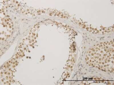 Immunohistochemistry-Paraffin: NUDT21 Antibody (3F8) [H00011051-M12]