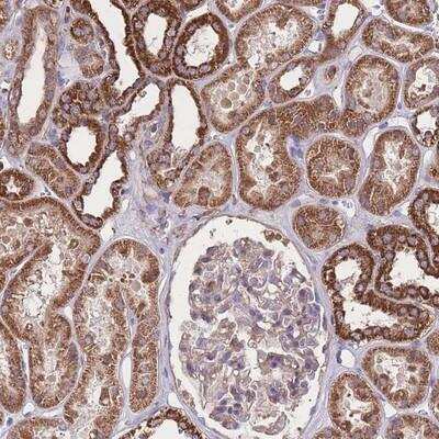 Immunohistochemistry: NUDT21 Antibody [NBP2-13682]