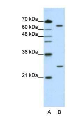 Western Blot: NUDT21 Antibody [NBP1-57540]