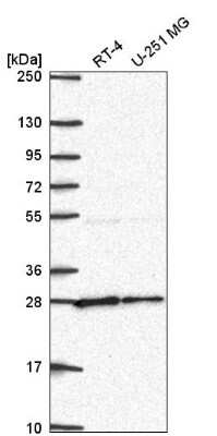 Western Blot: NUDT21 Antibody [NBP2-57491]