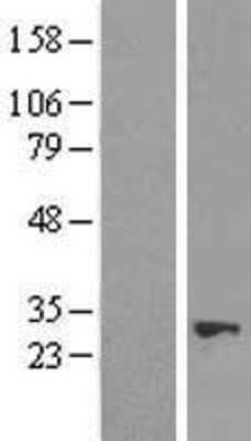 Western Blot: NUDT21 Overexpression Lysate [NBL1-13861]