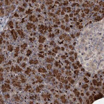 Immunohistochemistry-Paraffin: NUDT22 Antibody [NBP1-82754]
