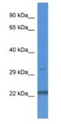 Western Blot: NUDT22 Antibody [NBP1-74263]