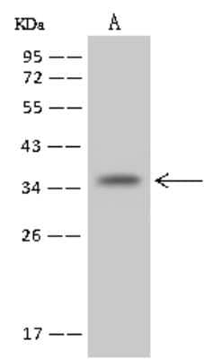 Western Blot: NUDT22 Antibody [NBP2-98534]