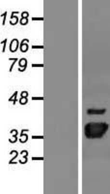 Western Blot: NUDT22 Overexpression Lysate [NBP2-09481]