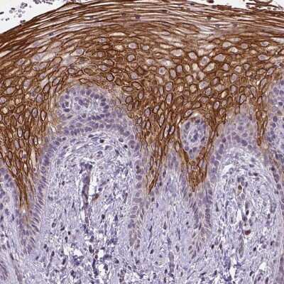 Immunohistochemistry: NUDT3 Antibody [NBP2-49205]