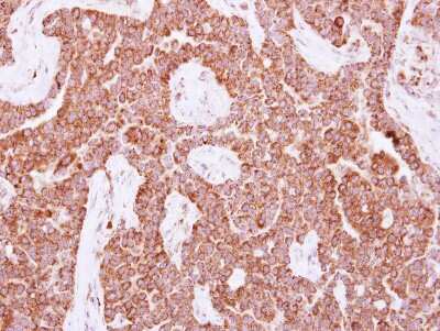 Immunohistochemistry-Paraffin: NUDT3 Antibody [NBP2-15048]