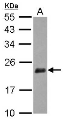 Western Blot: NUDT3 Antibody [NBP2-15048]