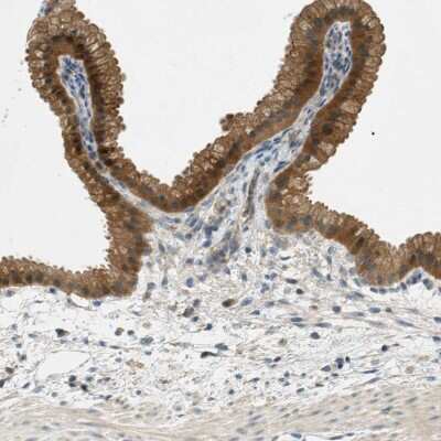 Immunohistochemistry-Paraffin: NUDT4 Antibody [NBP1-84250]
