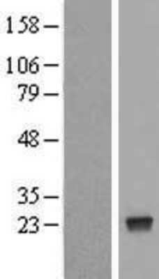 Western Blot: NUDT4 Overexpression Lysate [NBL1-13863]