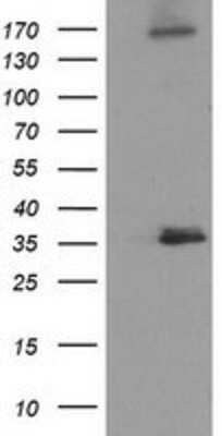 Western Blot: NUDT6 Antibody (OTI9D12) [NBP2-03554]