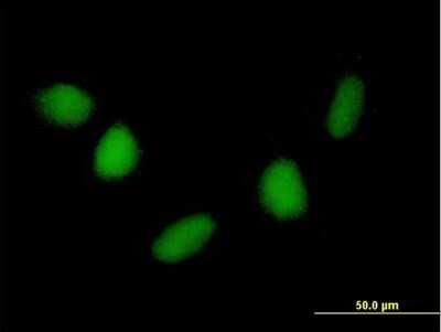 Immunocytochemistry/ Immunofluorescence: NUDT6 Antibody [H00011162-B01P]