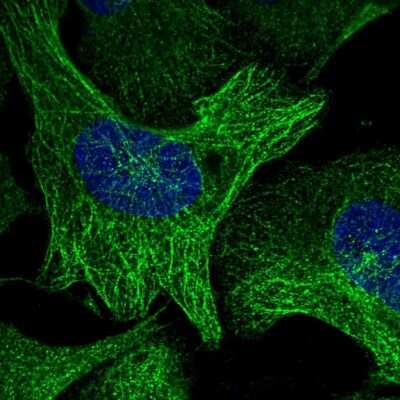 Immunocytochemistry/ Immunofluorescence: NUDT6 Antibody [NBP1-84688]