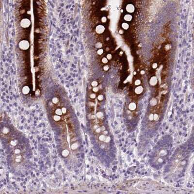 Immunohistochemistry: NUDT6 Antibody [NBP2-49473]