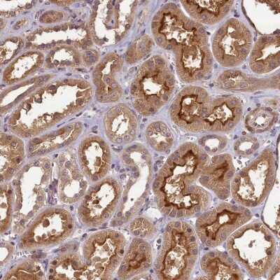 Immunohistochemistry-Paraffin: NUDT6 Antibody [NBP1-84688]