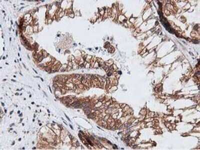 Immunohistochemistry: NUDT6 Antibody (OTI9D12) - Azide and BSA Free [NBP2-73121]