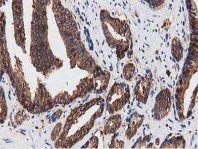 Immunohistochemistry: NUDT6 Antibody (OTI9D12) - Azide and BSA Free [NBP2-73121]