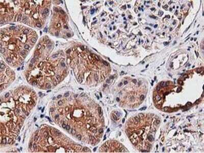 Immunohistochemistry: NUDT6 Antibody (OTI9D12) - Azide and BSA Free [NBP2-73121]