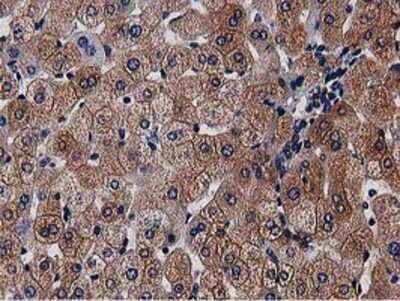 Immunohistochemistry: NUDT6 Antibody (OTI9D12) - Azide and BSA Free [NBP2-73121]
