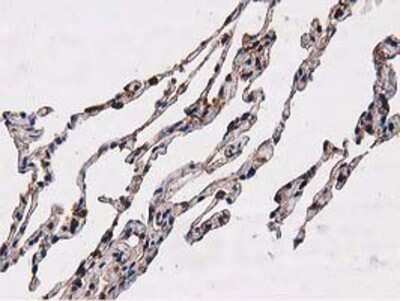 Immunohistochemistry: NUDT6 Antibody (OTI9D12) - Azide and BSA Free [NBP2-73121]