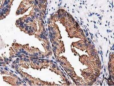Immunohistochemistry: NUDT6 Antibody (OTI9D12) - Azide and BSA Free [NBP2-73121]