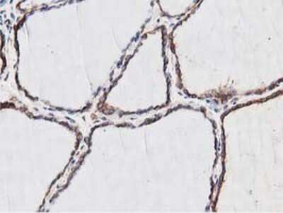Immunohistochemistry: NUDT6 Antibody (OTI9D12) - Azide and BSA Free [NBP2-73121]