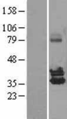 Western Blot: NUDT6 Overexpression Lysate [NBL1-13865]