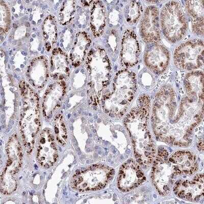 Immunohistochemistry-Paraffin: NUDT7 Antibody [NBP1-91125]