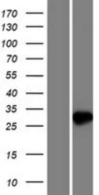 Western Blot: NUDT7 Overexpression Lysate [NBP2-09363]