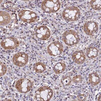 Immunohistochemistry-Paraffin: NUDT8 Antibody [NBP1-81907]