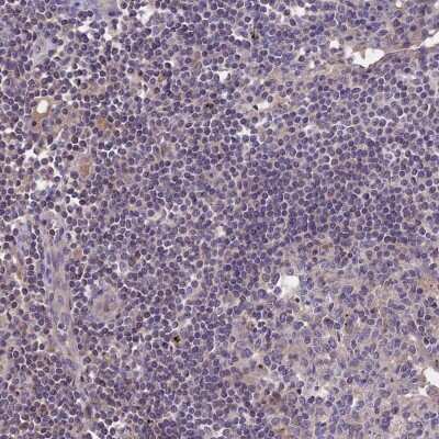 Immunohistochemistry-Paraffin: NUDT8 Antibody [NBP1-81907]