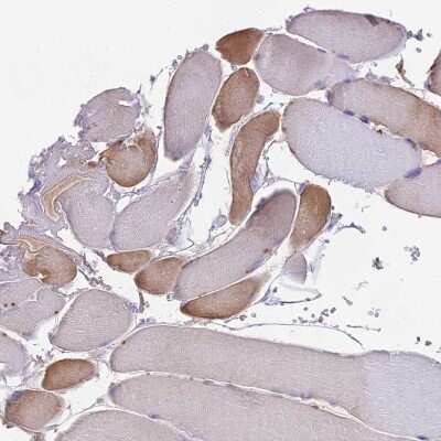 Immunohistochemistry-Paraffin: NUDT8 Antibody [NBP1-81907]
