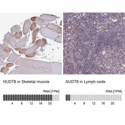 Immunohistochemistry-Paraffin: NUDT8 Antibody [NBP1-81907]