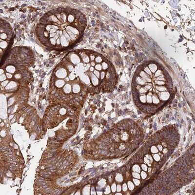 Immunohistochemistry-Paraffin: NUDT8 Antibody [NBP1-81908]